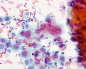 Figure 3: A cytology smear to help make a diagnosis